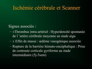 Signes associés :
– ±Thrombus intra-artériel : Hyperdensité spontanée
de l ’artère cérébrale moyenne au stade aigu
– ± Effet de masse : œdème vasogénique associée
– Rupture de la barrière hémato-encéphalique : Prise
de contraste corticale gyriforme au stade
intermédiaire (5j-5sem)
Ischémie cérébrale et Scanner
 