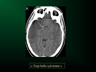 « Trop belle sylvienne »
 