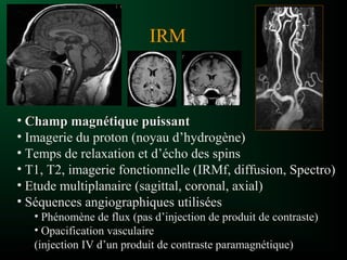IRM
• Champ magnétique puissantChamp magnétique puissant
• Imagerie du proton (noyau d’hydrogène)
• Temps de relaxation et d’écho des spins
• T1, T2, imagerie fonctionnelle (IRMf, diffusion, Spectro)
• Etude multiplanaire (sagittal, coronal, axial)
• Séquences angiographiques utilisées
• Phénomène de flux (pas d’injection de produit de contraste)
• Opacification vasculaire
(injection IV d’un produit de contraste paramagnétique)
 