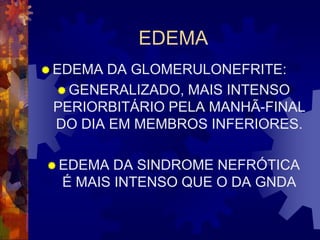 EDEMA
 EDEMA DA GLOMERULONEFRITE:
  GENERALIZADO, MAIS INTENSO
 PERIORBITÁRIO PELA MANHÃ-FINAL
 DO DIA EM MEMBROS INFERIORES.

 EDEMA  DA SINDROME NEFRÓTICA
  É MAIS INTENSO QUE O DA GNDA
 