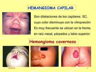 Semiología del neonato | PPT