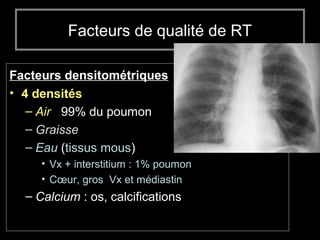 Facteurs de qualité de RT
Facteurs densitométriques :
• 4 densités
– Air : 99% du poumon
– Graisse
– Eau (tissus mous)
• Vx + interstitium : 1% poumon
• Cœur, gros Vx et médiastin
– Calcium : os, calcifications
 