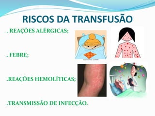RISCOS DA TRANSFUSÃO
. REAÇÕES ALÉRGICAS;
. FEBRE;
.REAÇÕES HEMOLÍTICAS;
.TRANSMISSÃO DE INFECÇÃO.
 