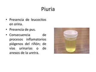 Piuria
• Presencia de leucocitos
  en orina.
• Presencia de pus.
• Consecuencia         de
  procesos inflamatorios
  piógenos del riñón; de
  vìas urinarias o de
  anexos de la uretra.
 