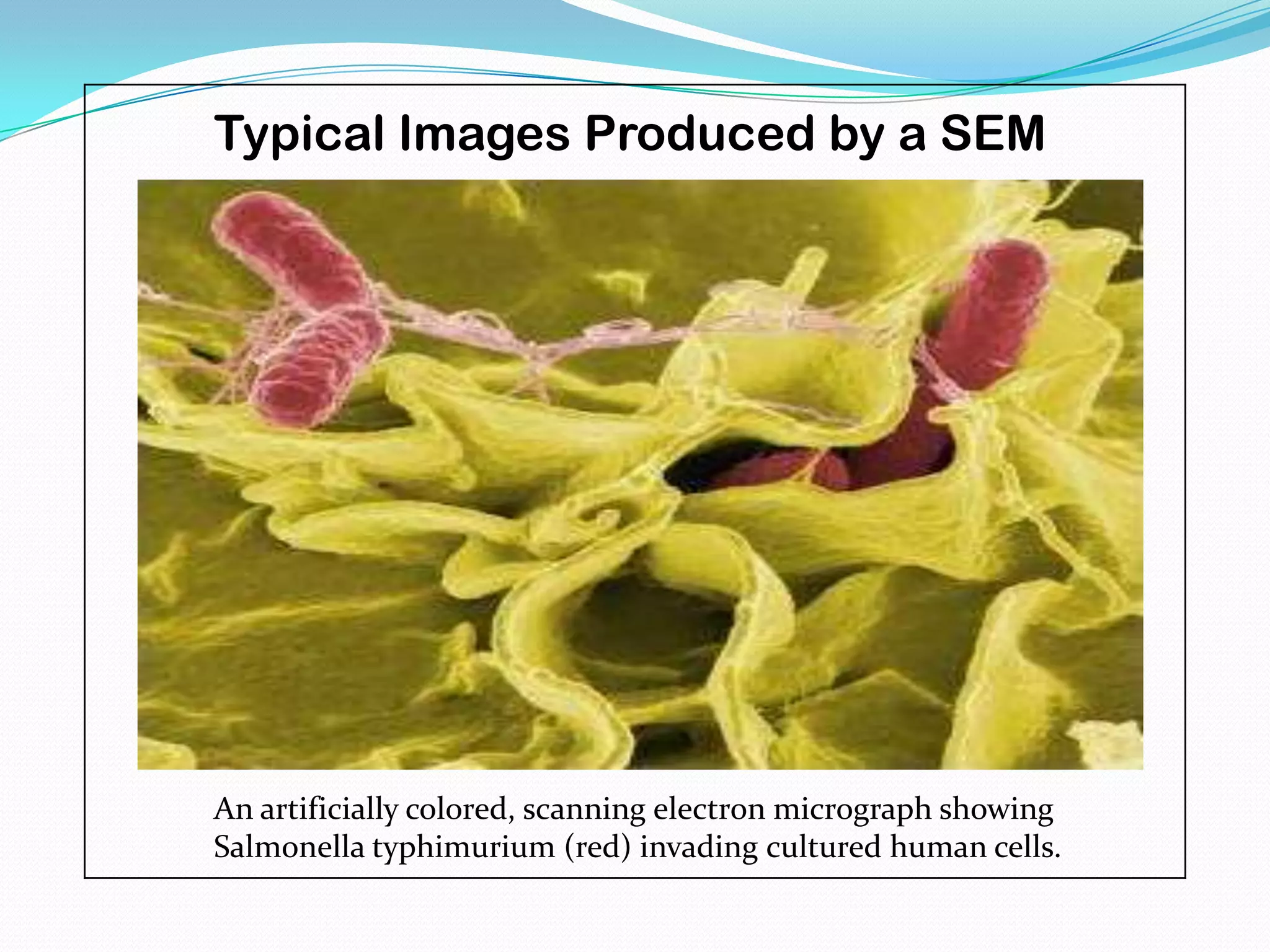 Typical Images Produced by a SEM




An artificially colored, scanning electron micrograph showing
Salmonella typhimurium (red) invading cultured human cells.
 
