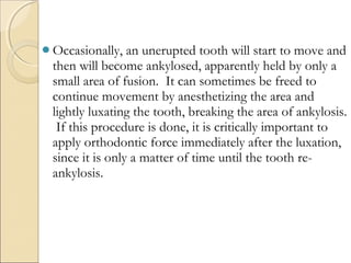 Teeth Leveling leveling and aligning in orthodontics | PPT
