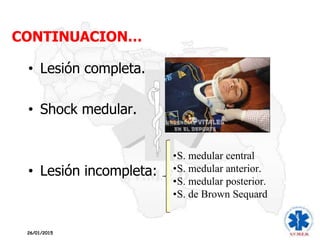 CONTINUACION…
• Lesión completa.
• Shock medular.
• Lesión incompleta:
•S. medular central
•S. medular anterior.
•S. medular posterior.
•S. de Brown Sequard
26/01/2015
 