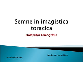 Computer tomografieComputer tomografie
Medic rezident:Bica
Mihaela Felicia
 
