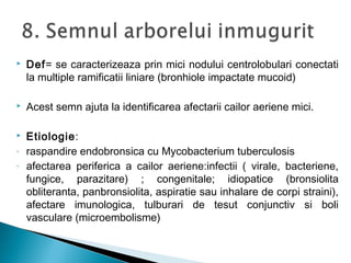  Def= se caracterizeaza prin mici nodului centrolobulari conectati
la multiple ramificatii liniare (bronhiole impactate mucoid)
 Acest semn ajuta la identificarea afectarii cailor aeriene mici.
 Etiologie:
- raspandire endobronsica cu Mycobacterium tuberculosis
- afectarea periferica a cailor aeriene:infectii ( virale, bacteriene,
fungice, parazitare) ; congenitale; idiopatice (bronsiolita
obliteranta, panbronsiolita, aspiratie sau inhalare de corpi straini),
afectare imunologica, tulburari de tesut conjunctiv si boli
vasculare (microembolisme)
 