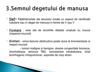  Def= hiperdensitati ale tesutului moale cu aspect de ramificatii
tubulare sau in deget de manusa in forme de V sau Y
 Formare : este dat de bronhiile dilatate umplute cu mucus
(impactul mucoid)
 Entitati: -orice leziune obstructiva poate duce la bronsiectazie si
impact mucoid
- tumori maligne si benigne, atrezie congenitala bronsica,
bronholitiaza, strictura TBC, sechestrare intralobulara, chist
bronhogenic intrapulmonar, aspiratie de corp strain
 