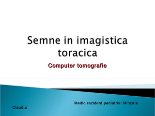 Computer tomografieComputer tomografie
Medic rezident pediatrie: Minzala
Claudiu
 
