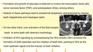 • Formation and growth of placodes is believed to involve the transcription factor p63,
tumor necrosis factor (TNF), and ectodysplasin (Eda), among others.
• Defects in these pathways lead to ectodermal dysplasia's characterized by missing
teeth (oligodontia) and misshapen teeth.
• On the other hand, over activation of the Eda receptor
leads to extra teeth with aberrant morphology.
• Inhibition of Wnt signaling by overexpressing the Wnt inhibitor Dkk1 prevents the
formation of tooth placodes and the initiation of teeth fails, pointing to Wnt as the
most upstream signal and the inducer of tooth initiation.
 