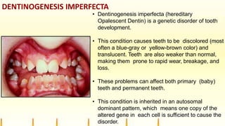 DENTINOGENESIS IMPERFECTA
• Dentinogenesis imperfecta (hereditary
Opalescent Dentin) is a genetic disorder of tooth
development.
• This condition causes teeth to be discolored (most
often a blue-gray or yellow-brown color) and
translucent. Teeth are also weaker than normal,
making them prone to rapid wear, breakage, and
loss.
• These problems can affect both primary (baby)
teeth and permanent teeth.
• This condition is inherited in an autosomal
dominant pattern, which means one copy of the
altered gene in each cell is sufficient to cause the
disorder.
 