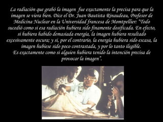 La radiación que grabó la imagen  fue exactamente la precisa para que la imagen se viera bien. Dice el Dr. Juan Bautista Rinaudeau, Profesor de Medicina Nuclear en la Universidad francesa de Momtpellier: “Todo sucedió como si esa radiación hubiera sido finamente dosificada. En efecto, si hubiera habido demasiada energía, la imagen hubiera resultado excesivamente oscura; y si, por el contrario, la energía hubiera sido escasa, la imagen hubiese sido poco contrastada, y por lo tanto ilegible.  Es exactamente como si alguien hubiera tenido la intención precisa de provocar la imagen”. 
