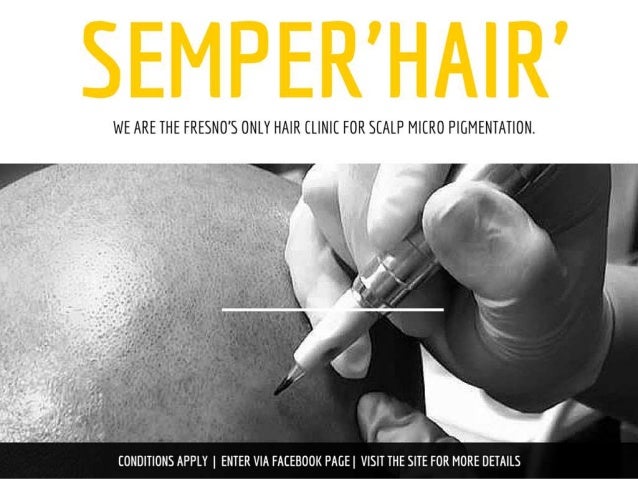 Fresno Scalp Micropigmentation Treatment Center: Semperhair