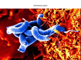 Helicobacter pylori 