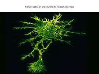 Fibra de actina en una neurona del hipocampo de rata 