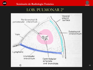 LOB. PULMONAR 2º 