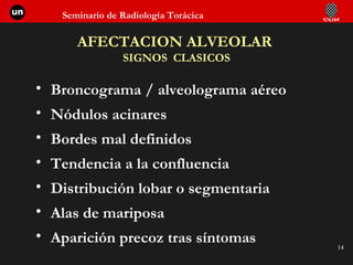 AFECTACION ALVEOLAR  SIGNOS  CLASICOS Broncograma / alveolograma aéreo  Nódulos acinares  Bordes mal definidos  Tendencia a la confluencia  Distribución lobar o segmentaria Alas de mariposa  Aparición precoz tras síntomas 