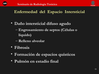 Enfermedad  del  Espacio  Intersticial Daño intersticial difuso agudo Engrosamiento de septos (Células o líquido) Relleno alveolar Fibrosis Formación de espacios quísticos Pulmón en estadio final 