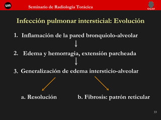 Infección pulmonar intersticial: Evolución Inflamación de la pared bronquiolo-alveolar Edema y hemorragia, extensión parcheada Generalización de edema intersticio-alveolar a. Resolución b. Fibrosis: patrón reticular 1.  2.  3.  