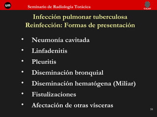 Infección pulmonar tuberculosa Reinfección: Formas de presentación Neumonía cavitada Linfadenitis Pleuritis Diseminación bronquial Diseminación hematógena (Miliar) Fistulizaciones Afectación de otras vísceras 