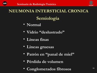 NEUMONIA INTERSTICIAL CRONICA Semiología Normal Vidrio “deslustrado” Líneas finas Lineas gruesas Patrón en “panal de miel” Pérdida de volumen Conglomerados fibrosos 