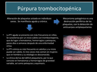 Púrpura trombocitopénicaPúrpura trombocitopénica
 