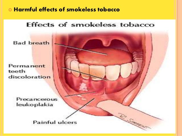 Smoking and COVID-19 | Smokefree Smoking and COVID-19 | Smokefree