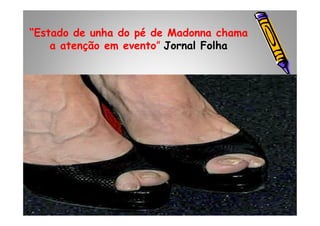 “Estado de unha do pé de Madonna chama
a atenção em evento” Jornal Folha
 