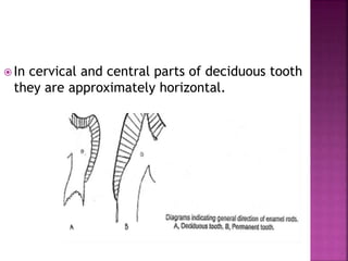  In cervical and central parts of deciduous tooth 
they are approximately horizontal. 
 