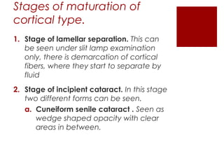 Stages of maturation of
cortical type.
1. Stage of lamellar separation. This can
be seen under slit lamp examination
only, there is demarcation of cortical
fibers, where they start to separate by
fluid
2. Stage of incipient cataract. In this stage
two different forms can be seen.
a. Cuneiform senile cataract . Seen as
wedge shaped opacity with clear
areas in between.
 
