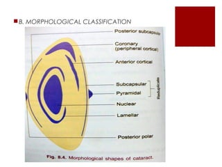 B. MORPHOLOGICAL CLASSIFICATION
 