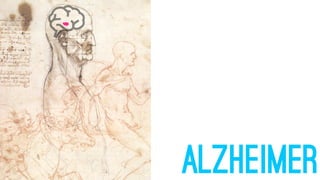 ALZHEIMER
 