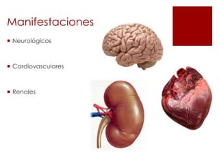Manifestaciones
 Neurológicos

 Cardiovasculares

 Renales

 
