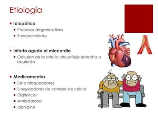 Etiología
 Idiopática
 Procesos degenerativos
 Envejecimiento

 Infarto agudo al miocardio
 Oclusion de la arteria circunfleja derecha o
izquierda

 Medicamentos
 Beta bloqueadores
 Bloqueadores de canales de calcio
 Digitalicos

 Amiodarona
 clonidina

 