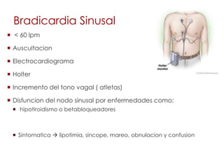 Bradicardia Sinusal
 < 60 lpm
 Auscultacion

 Electrocardiograma
 Holter
 Incremento del tono vagal ( atletas)

 Disfuncion del nodo sinusal por enfermedades como:
 hipotiroidismo o betabloqueadores

 Sintomatica  lipotimia, sincope, mareo, obnulacion y confusion

 