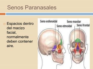 Senos Paranasales

   Espacios dentro
    del macizo
    facial,
    normalmente
    deben contener
    aire.
 