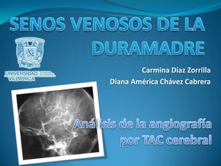 SENOS VENOSOS DE LA DURAMADRE Carmina Díaz Zorrilla Diana América Chávez Cabrera Análisis de la angiografía por TAC cerebral 