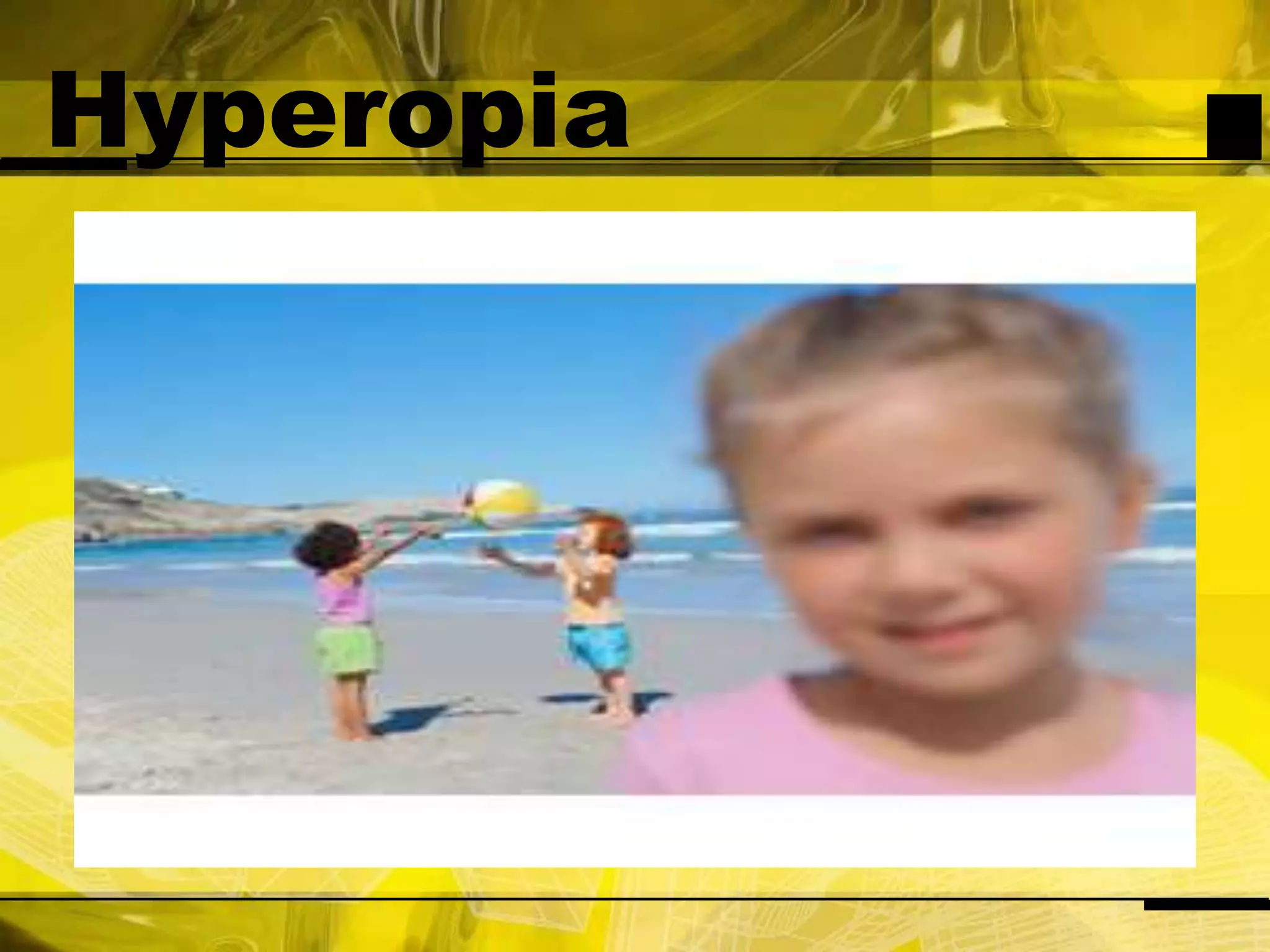 Hyperopia