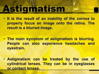 AstigmatismIt is the result of an inability of the cornea to properly focus an image onto the retina. The result is a blurred image.The main symptom of astigmatism is blurring. People can also experience headaches and eyestrain.Astigmatism can be treated by the use of cylindrical lenses. They can be in eyeglasses or contact lenses.