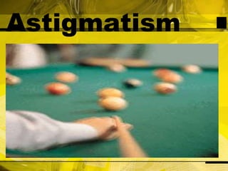 Astigmatism