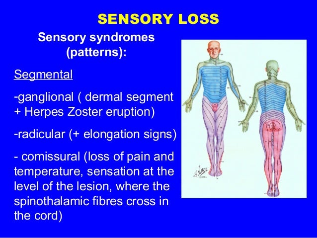 Sensory loss definition image
