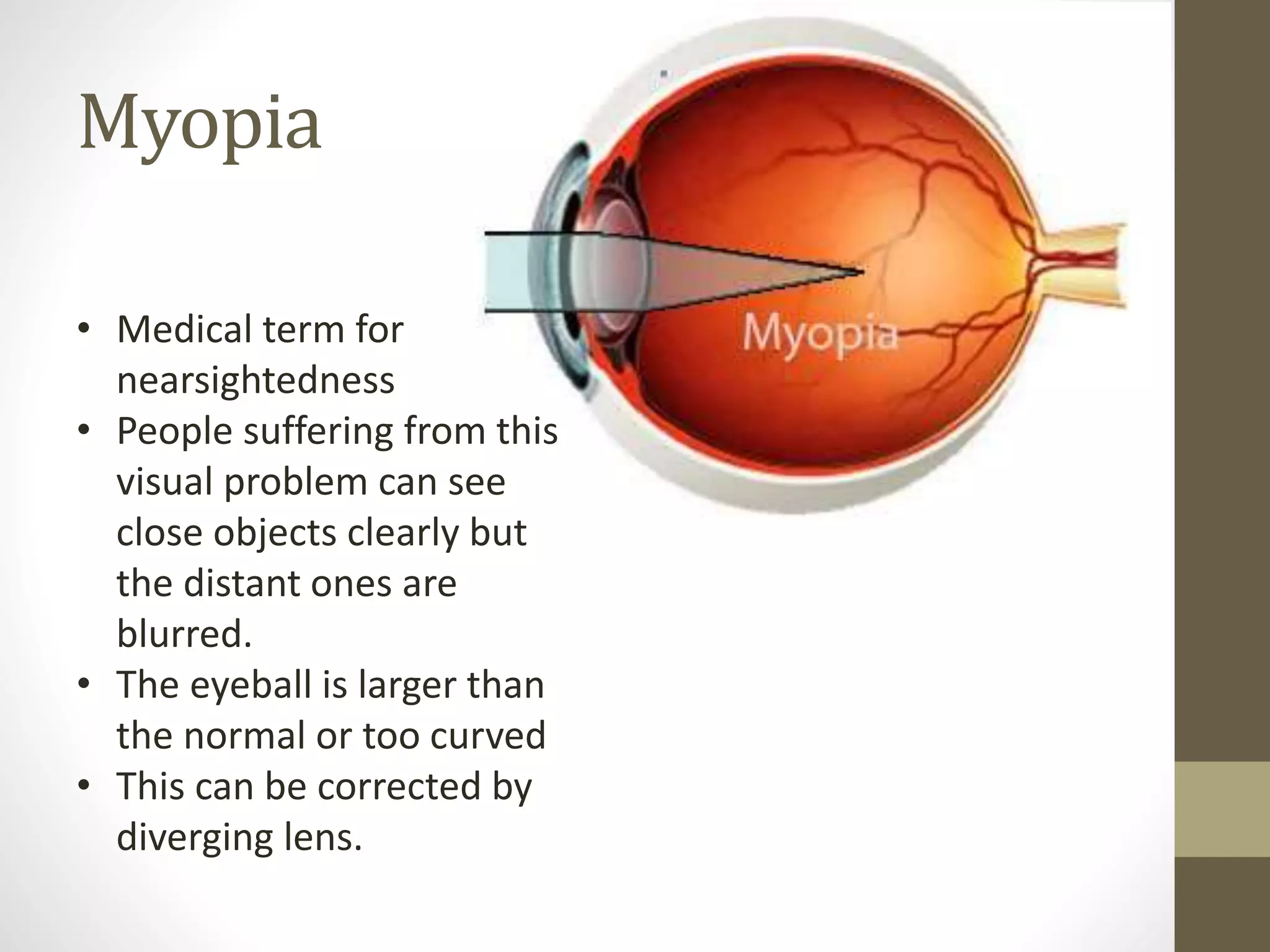Myopia
• Medical term for
nearsightedness
• People suffering from this
visual problem can see
close objects clearly but
the distant ones are
blurred.
• The eyeball is larger than
the normal or too curved
• This can be corrected by
diverging lens.
 