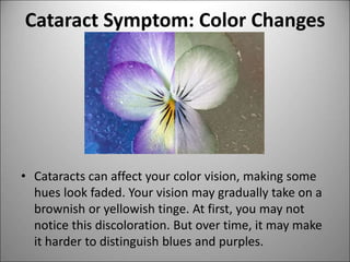 Sense of sight (structure of the eye.pptx) | PPT