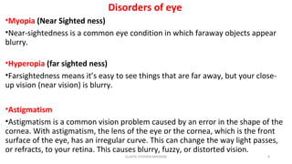 Disorders of eye
•Myopia (Near Sighted ness)
•Near-sightedness is a common eye condition in which faraway objects appear
blurry.
•Hyperopia (far sighted ness)
•Farsightedness means it’s easy to see things that are far away, but your close-
up vision (near vision) is blurry.
•Astigmatism
•Astigmatism is a common vision problem caused by an error in the shape of the
cornea. With astigmatism, the lens of the eye or the cornea, which is the front
surface of the eye, has an irregular curve. This can change the way light passes,
or refracts, to your retina. This causes blurry, fuzzy, or distorted vision.
GLADYS STEPHEN MPHARM 9
 