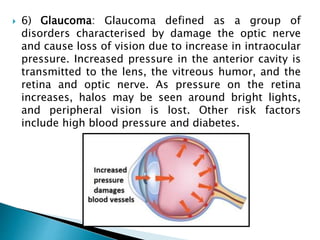  6) Glaucoma: Glaucoma defined as a group of
disorders characterised by damage the optic nerve
and cause loss of vision due to increase in intraocular
pressure. Increased pressure in the anterior cavity is
transmitted to the lens, the vitreous humor, and the
retina and optic nerve. As pressure on the retina
increases, halos may be seen around bright lights,
and peripheral vision is lost. Other risk factors
include high blood pressure and diabetes.
 