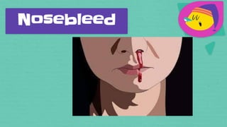 Nosebleed
 