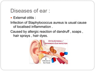 Diseases of ear :
 External otitis :
Infection of Staphylococcus aureus is usual cause
of localised inflammation .
Caused by allergic reaction of dandruff , soaps ,
hair sprays , hair dyes.
 