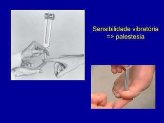 Sensibilidade vibratória
=> palestesia
 
